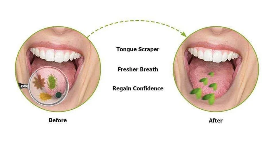 tongue cleaner tongue cleaner